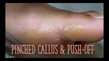 Every Foot Tells a Story   Bridging Assessment to Function with Dr Emily Splichal