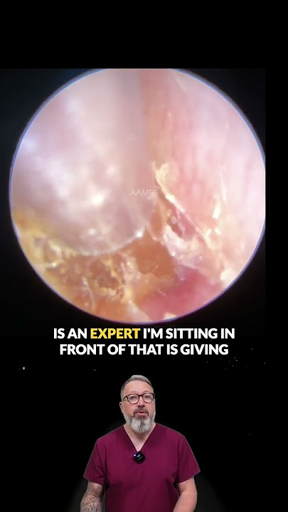 Bad Practice in Hearing Care? This Audiologist Isn’t Holding Back! 🔊👂