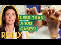 Dr Sarah Helps Patient Manage Her Rare INCURABLE Foot Condition My Feet Are Killing Me Dr Sarah Helps Patient Manage Her Rare INCURABLE Foot Condition My Feet Are Killing Me