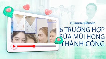6 TRƯỜNG HỢP SỬA MŨI HỎNG THÀNH CÔNG TẠI BS PHÙNG MẠNH CƯỜNG