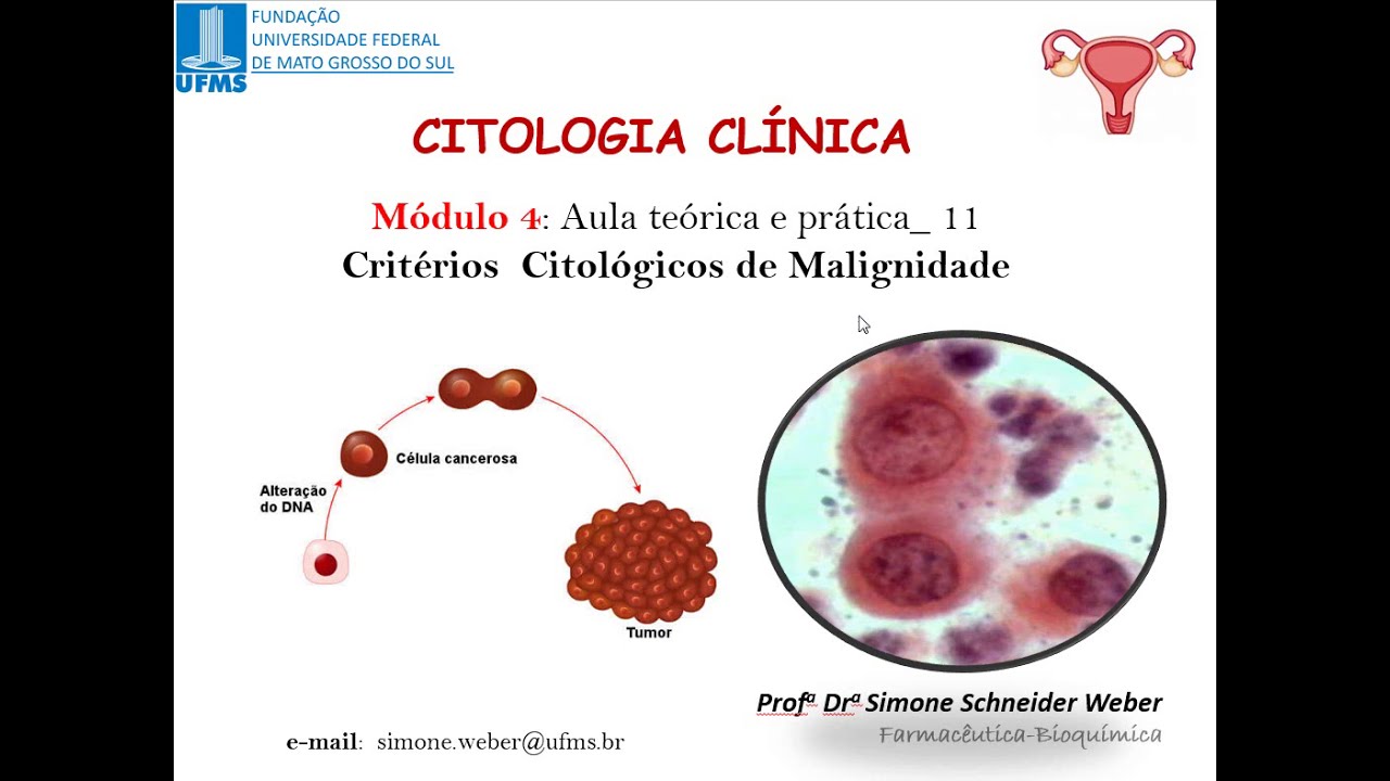 UNIDADE 4 _ Aula teórica e prática 11_Critérios Citológicos de ...