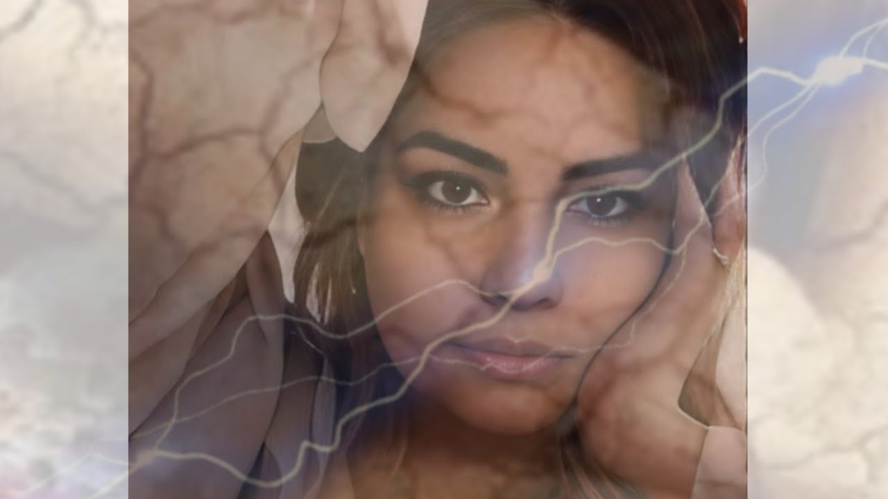 La FIBROMIALGIA ME J©D!0 la EXISTENCIA