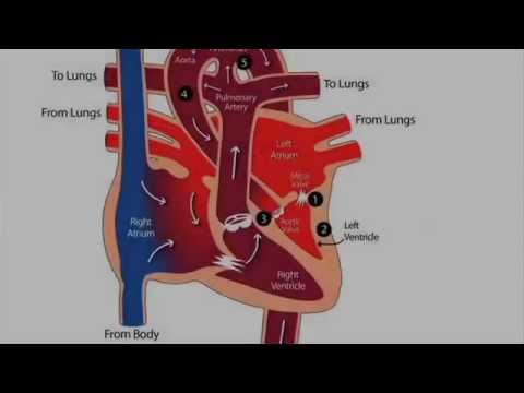 Video: Hvad er meningen med hypoplastisk livmoder?