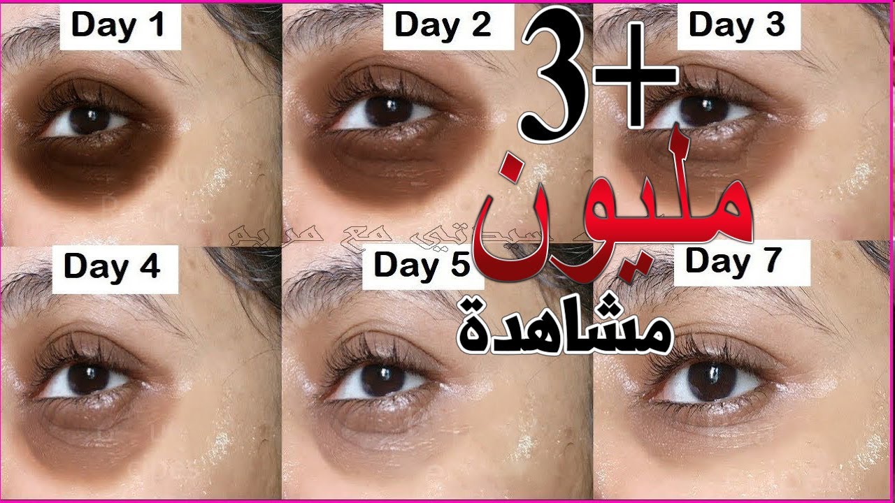 ضعيها ربع ساعه تحت العين و اقسم بالله النتيجة ستبهرك لعيون ساحرة بدون هالات سوداء وبدون انتفاخ مجربة