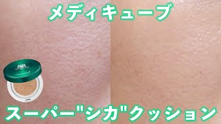 【すり鉢毛穴】ニキビの赤みを隠してくれるメディキューブスーパーシカクッションレビュー (ベースメイク/開き毛穴/いちご鼻/混合肌/ニキビ肌/酒さ/韓国コスメ/クッションファンデーション)