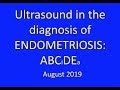 The ABCiDEa of how to diagnose endometriosis on pelvic ultrasound 2019