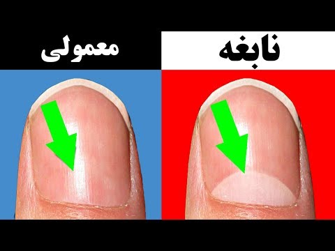 تصویری: چگونه نسبت حفره سقف را محاسبه می کنید؟