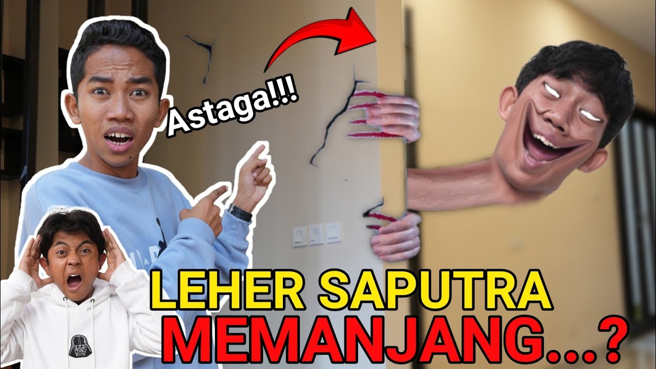 Saputra LEHERNYA TIDAK BISA Berhenti Tumbuh MEMANJANG!? Apa Yang Terjadi😱 | Mikael TubeHD