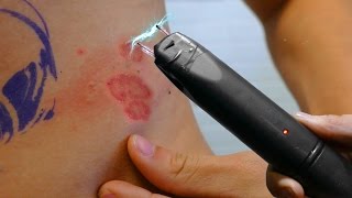 INSANE TATTOO TASER PRANK!!