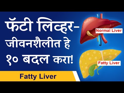 Top 10 tips for fatty liver  | फॅटी लिव्हर - जीवनशैलीत हे १० बदल करा! | Marathi |