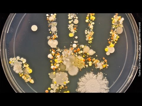 Video: Moterų rankose knibžda bakterijų
