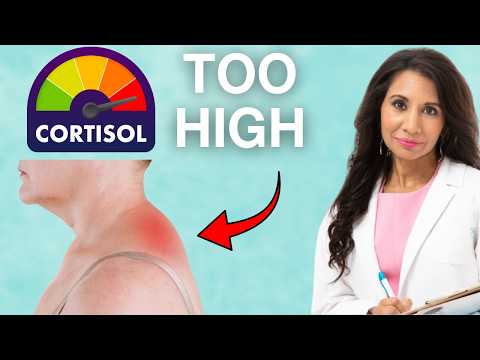 15 Signs of HIGH CORTISOL You Need to Watch for | Doctor Explains