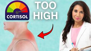 15 Signs of HIGH CORTISOL You Need to Watch for | Doctor Explains