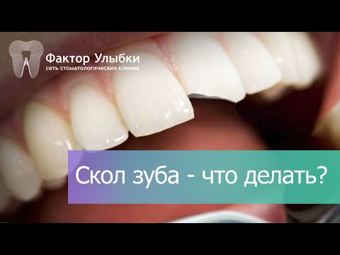 Что делать, если откололся кусок зуба