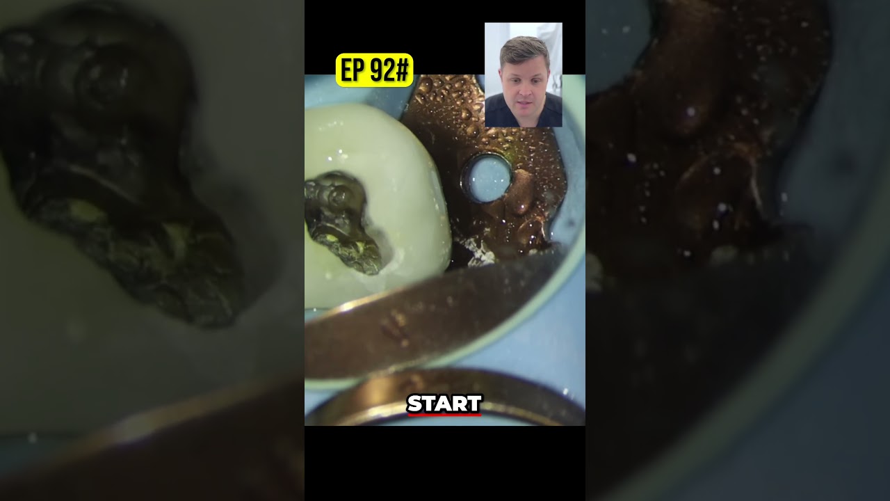 Dental Investigation  No Perforation! What We Found