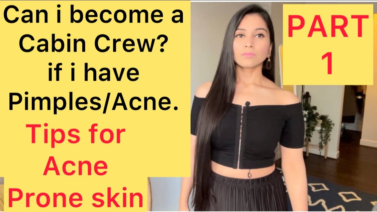can-i-become-a-cabin-crew-if-i-have-pimples-acne-tips-for-acne-prone