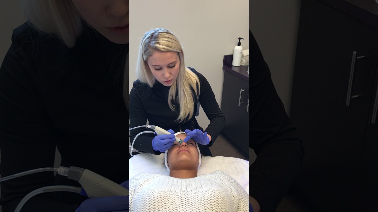 Hydrafacial -Step 3: Extractions