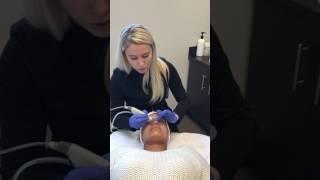 Hydrafacial -Step 3 Extractions