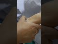 #viralvideo cannula kese nikaale🥶🥶#hospital #viralvideo #doctor #medicaltutorial #medical #viral