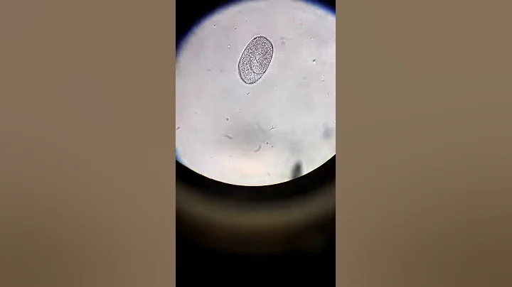 Larvating Strongyle