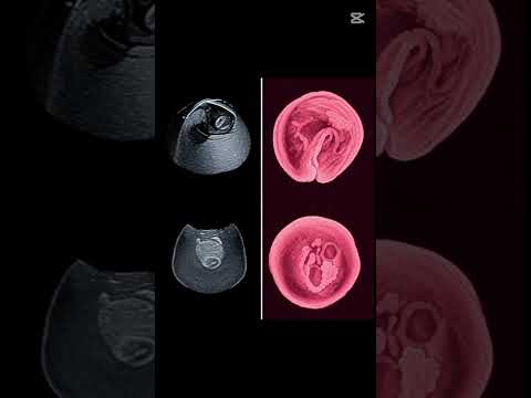 مرحلة المضغة السر الذي أدهش العلماء تأمل معلومات