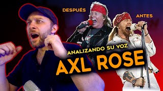 Analizando a una leyenda | AXL ROSE