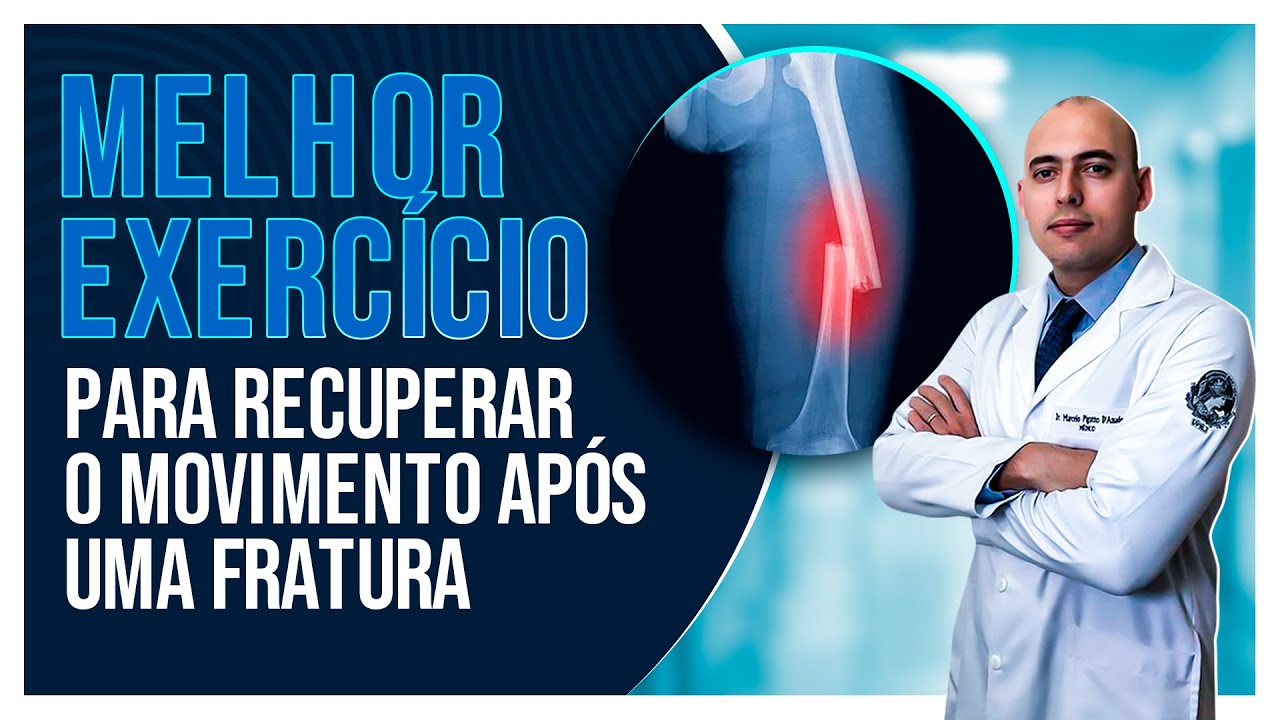 QUAL MELHOR EXERCÍCIO PARA VOCÊ RECUPERAR O MOVIMENTO APÓS UMA FRATURA?