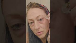 Reduce Wrinkles Fast Ubiskins Secret To Firmer Skin