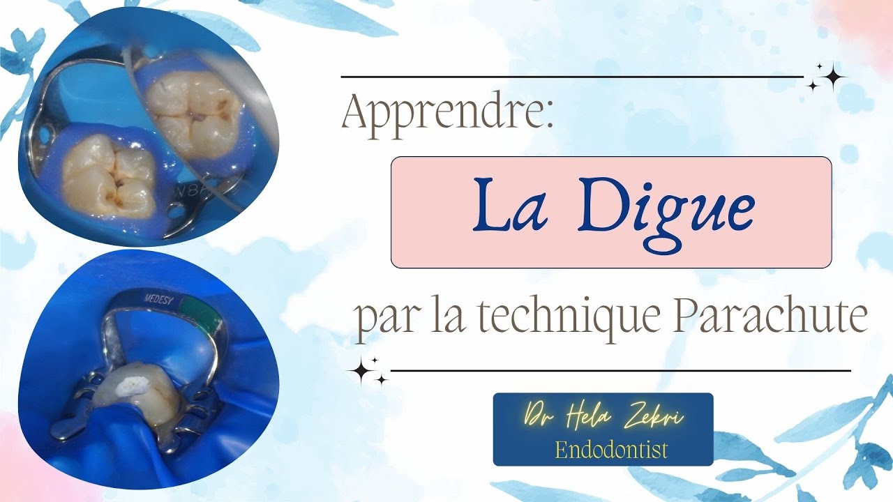 Apprendre la digue: Technique Parachute