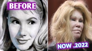 Jocelyn Wildenstein Then & Now Pics | #JocelynWildenstein | AmaZing Vedios |