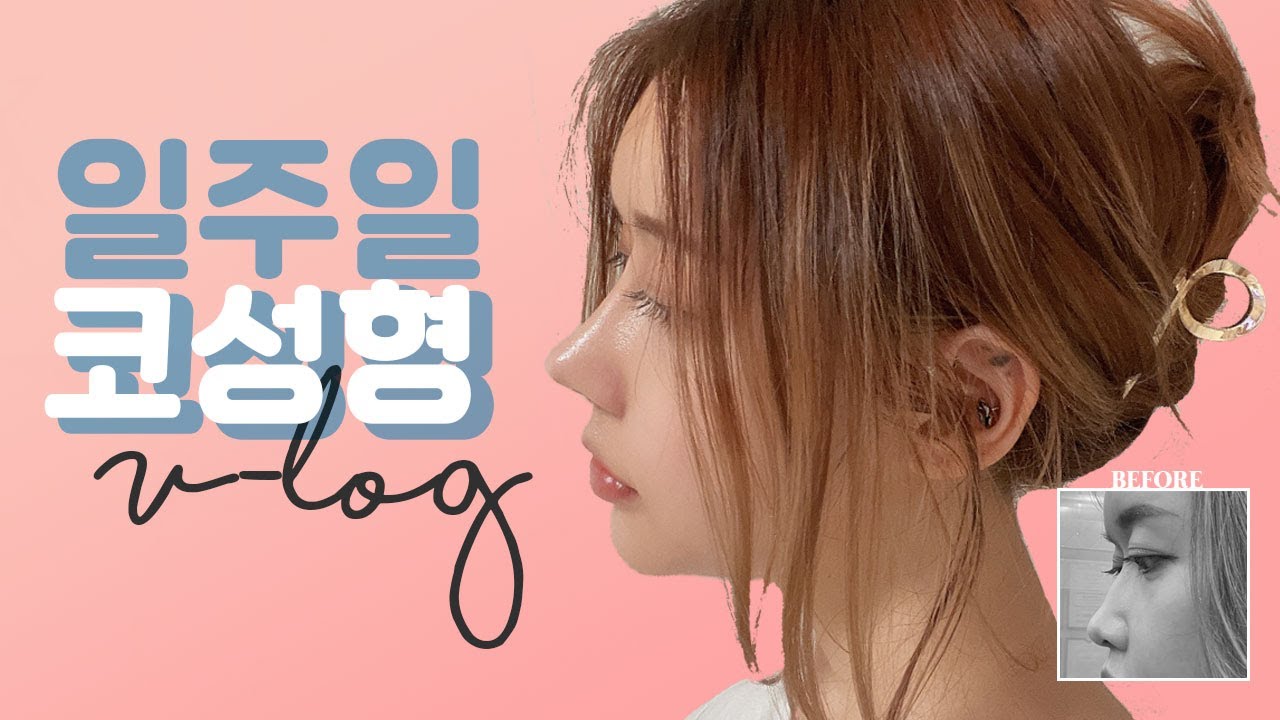 เสริม จมูก สไตล์ เกาหลี 2022 New NOSE SURGERY ONE WEEK VLOG ศัลยกรรมจมูกที่เกาหลีครั้งแรก! 🌻 첫 코성형 일주일 브이로그 | jqsmin 자스민