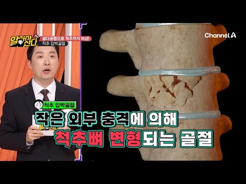 골다공증성 골절 발목과 척추도 위험하다!? | 알아야산다 13 회