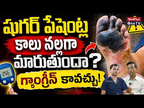 Can a Diabetic’s Foot Turn Black? It Could Be Gangrene! | Dr.Rahul Agarwal @MedPlusOneTV