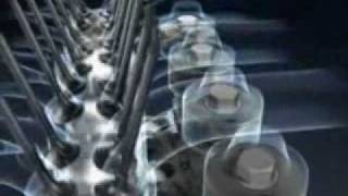 Variable Compression Ratio Car Engine: MCE-5 VCR-i