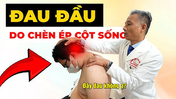 Đau Nửa Đầu Dữ Dội Không Uống Thuốc Nào Khỏi? Nguyên Nhân Mà Bạn Không Ngờ!| Y học Thể thao Starsmec