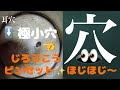 181 #耳掃除 #耳かき #穴 #耳瘻孔 #earwax 【耳瘻孔＝穴のピンセットお掃除動画】