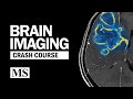 Brain imaging crash course