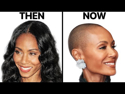 Jada Pinkett Smith | Women's Hair Loss Explained