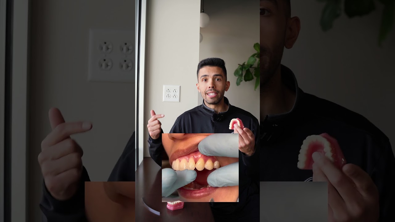 What Is IPR (Interproximal Reduction)?