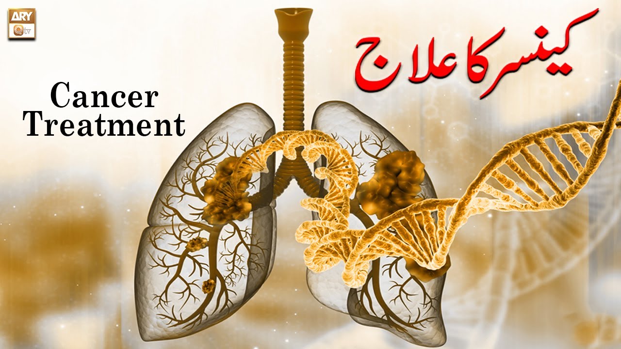 Cancer Ka Ilaj Cancer Treatment Hakeem Abdul Basit Healthtips
