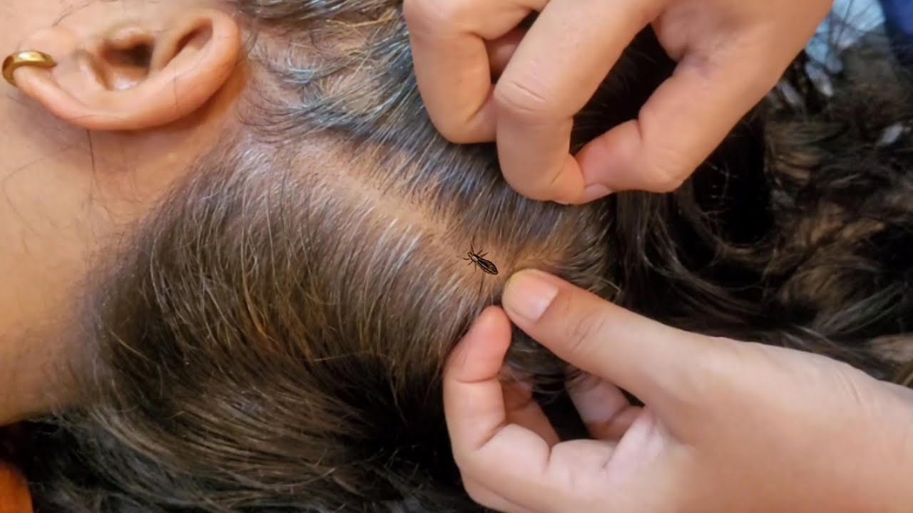 Scalp Check ASMR: The Ultimate Relaxation Experience