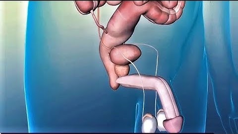 BPH or Prostate Cancer? Most Men Miss This Critical Difference