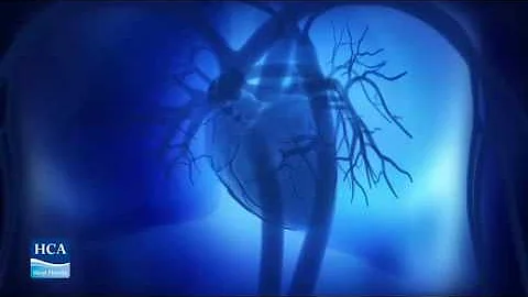 CONGESTIVE HEART FAILURE PATIENT EDUC 003