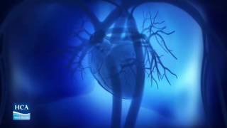 CONGESTIVE HEART FAILURE PATIENT EDUC 003