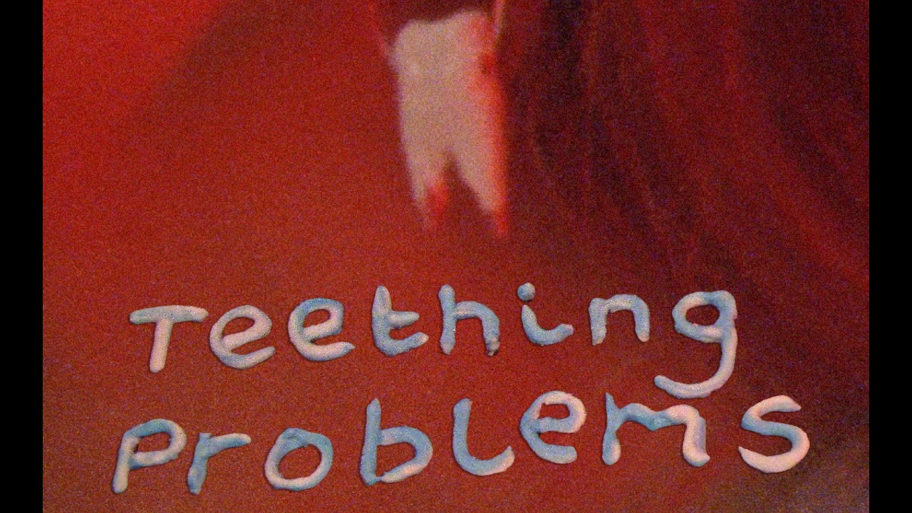 Teething Problems