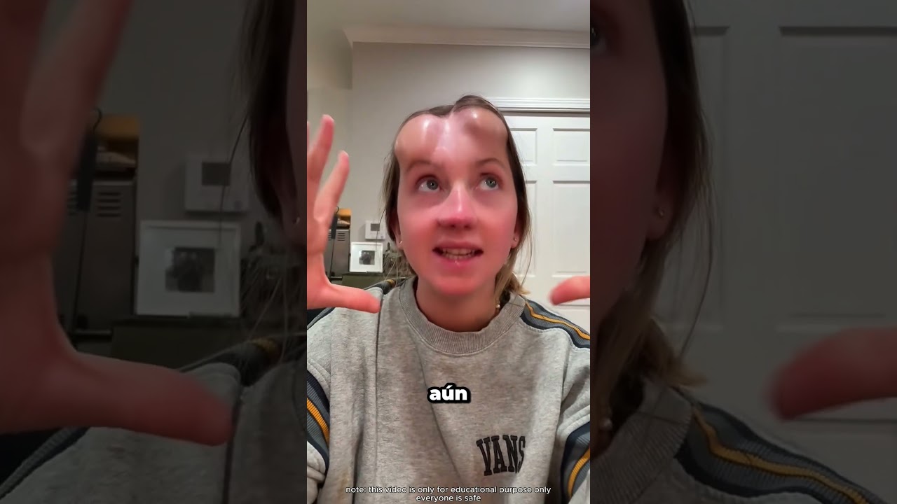 ¿Por qué tenía bultos en la frente?