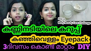 കഞ്ഞിവെള്ളം കൊണ്ട്  eye pack 3 ദിവസം കൊണ്ട്Remove Dark Circles Naturally At Home Reduce Eye sagging