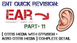 (OTITIS MEDIA with Effusion + AERO Otitis Media) Complete Detail | Dr Deen Lectures