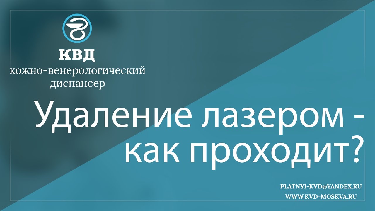 191 Удаление лазером - как проходит?