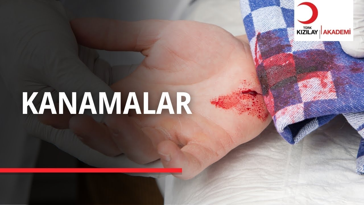 Burnumuz kanadığı zaman ne yapmalıyız?